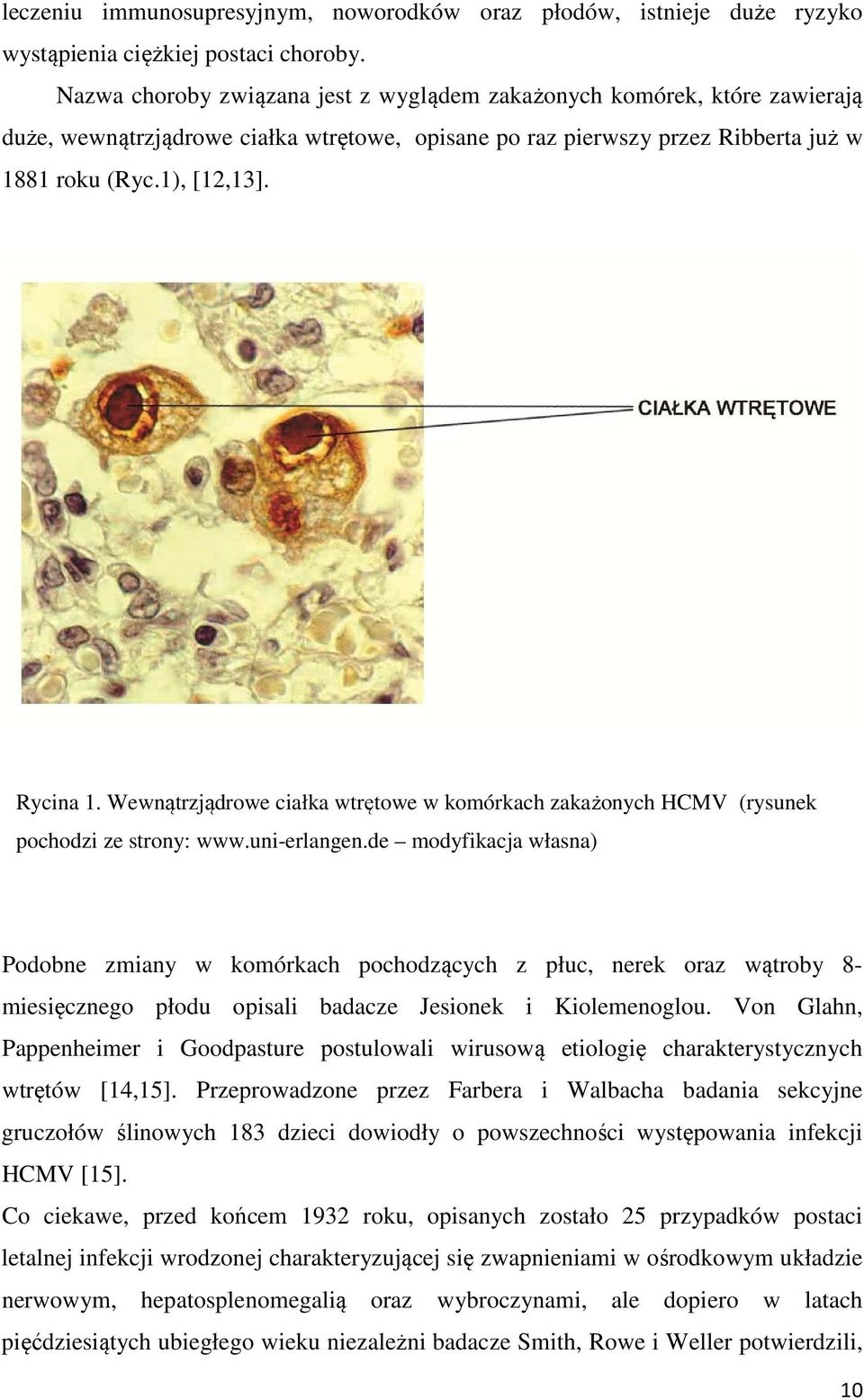 Wewnątrzjądrowe ciałka wtrętowe w komórkach zakażonych HCMV (rysunek pochodzi ze strony: www.uni-erlangen.