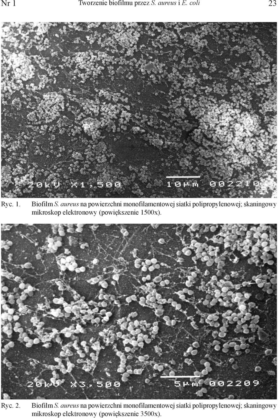 mikroskop elektronowy (powiększenie 1500x). Ryc. 2. Biofilm S.