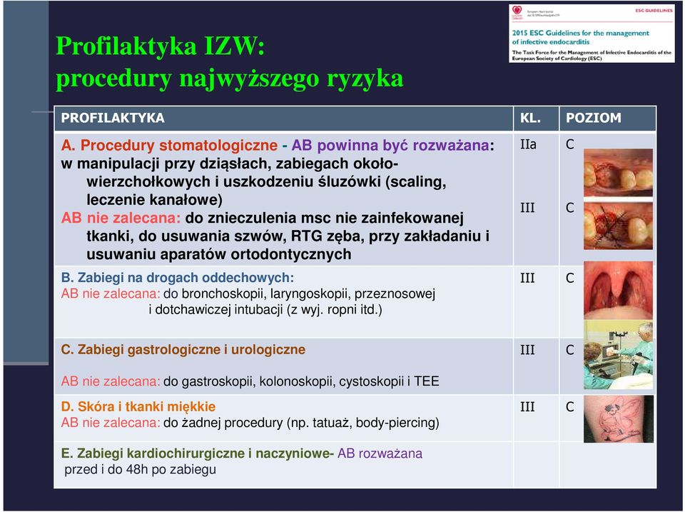 msc nie zainfekowanej tkanki, do usuwania szwów, RTG zęba, przy zakładaniu i usuwaniu aparatów ortodontycznych B.