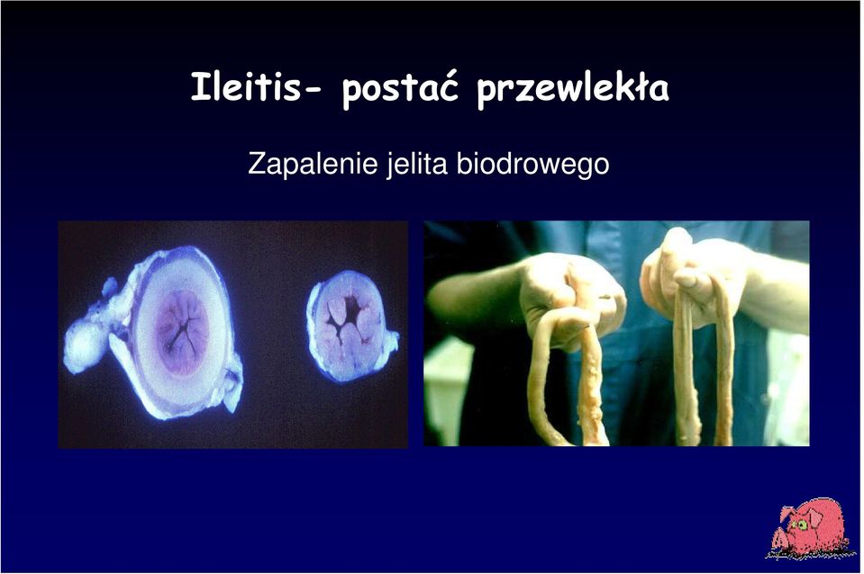 przewlekła