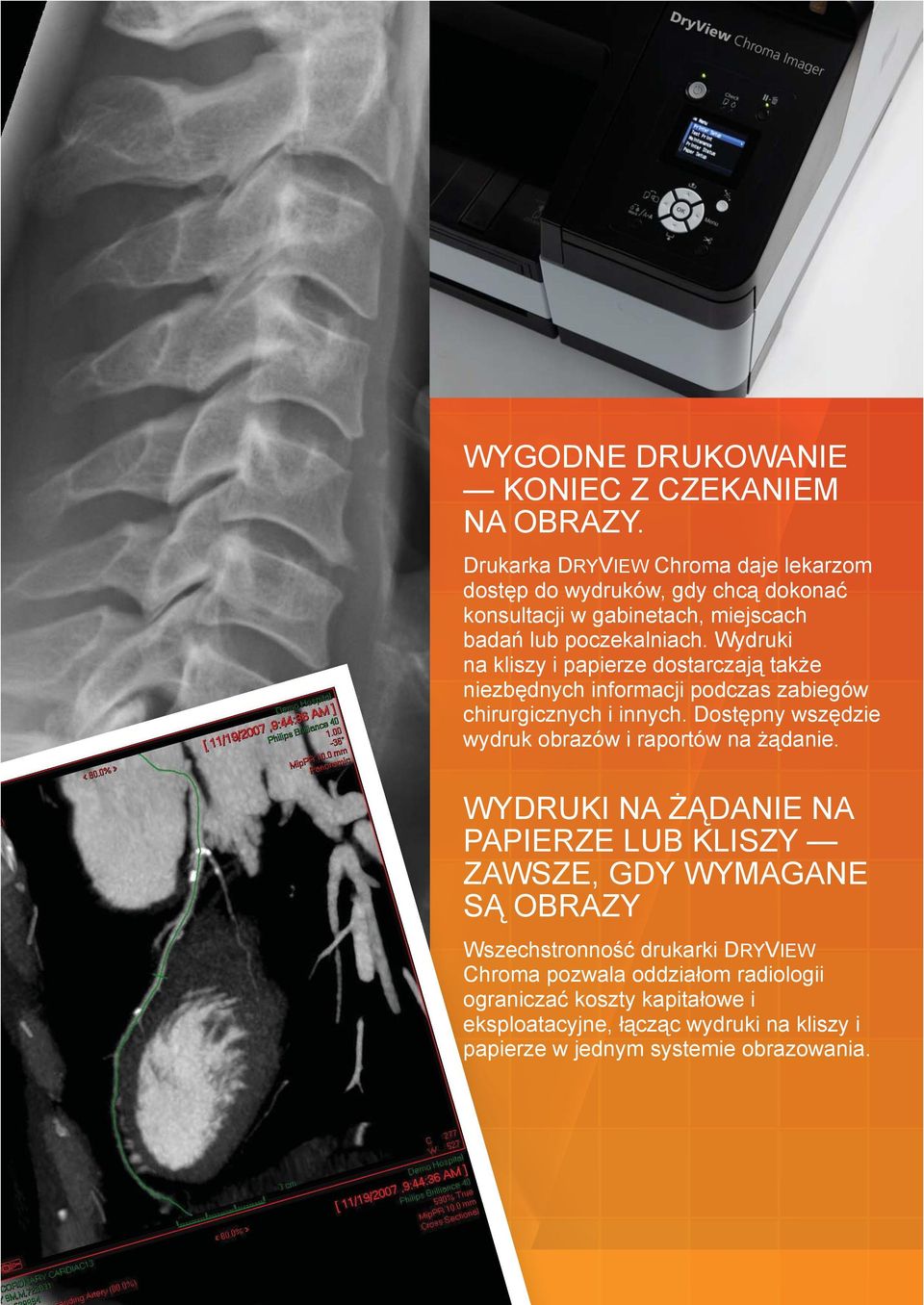 Wydruki na kliszy i papierze dostarczaj tak e niezb dnych informacji podczas zabiegów chirurgicznych i innych.