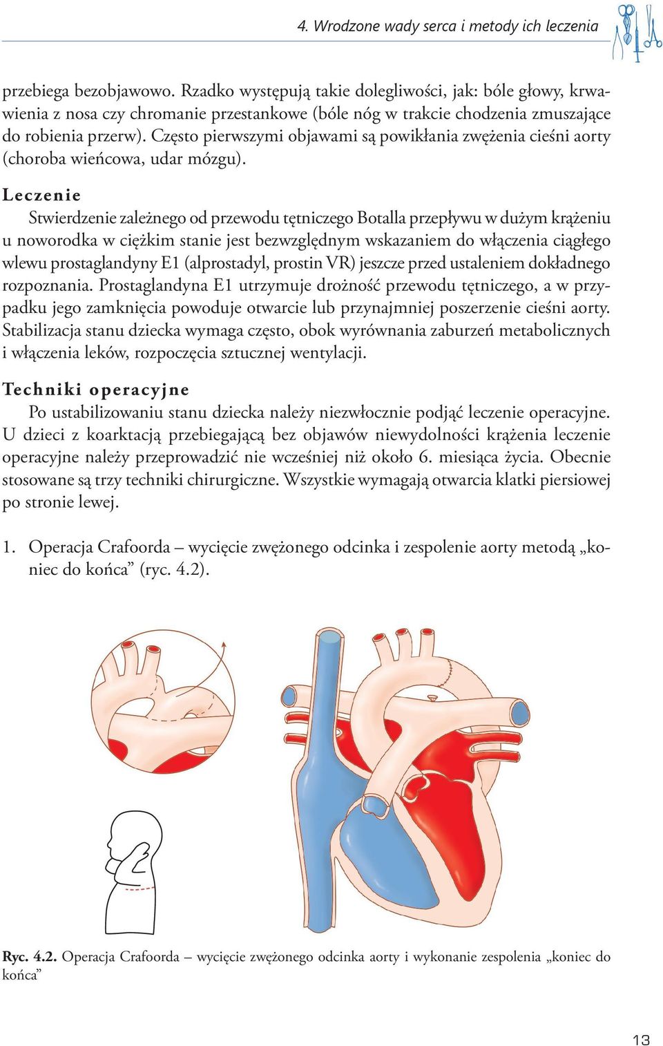 Często pierwszymi objawami są powikłania zwężenia cieśni aorty (choroba wieńcowa, udar mózgu).