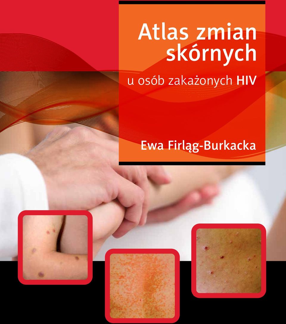 zakażonych HIV