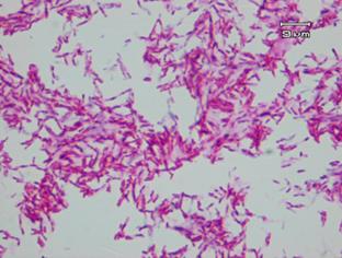 Rekomendacja 3 Pneumonol. Alergol.