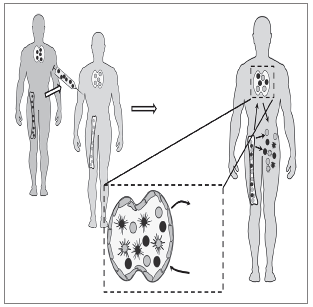 Rozwój mikrochimeryzmu Chorym poddanym wcześniejszej terapii: - mieloablacyjnej (całkowite zniszczenie hemopoezy biorcy za pomocą radioterapii lub chemioterapii), - niemieloablacyjne przeszczepienie