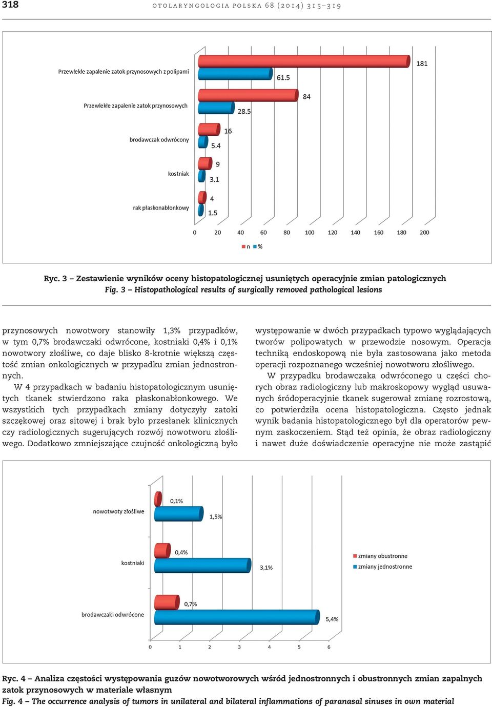 daje blisko 8-krotnie większą częstość zmian onkologicznych w przypadku zmian jednostronnych. W 4 przypadkach w badaniu histopatologicznym usuniętych tkanek stwierdzono raka płaskonabłonkowego.