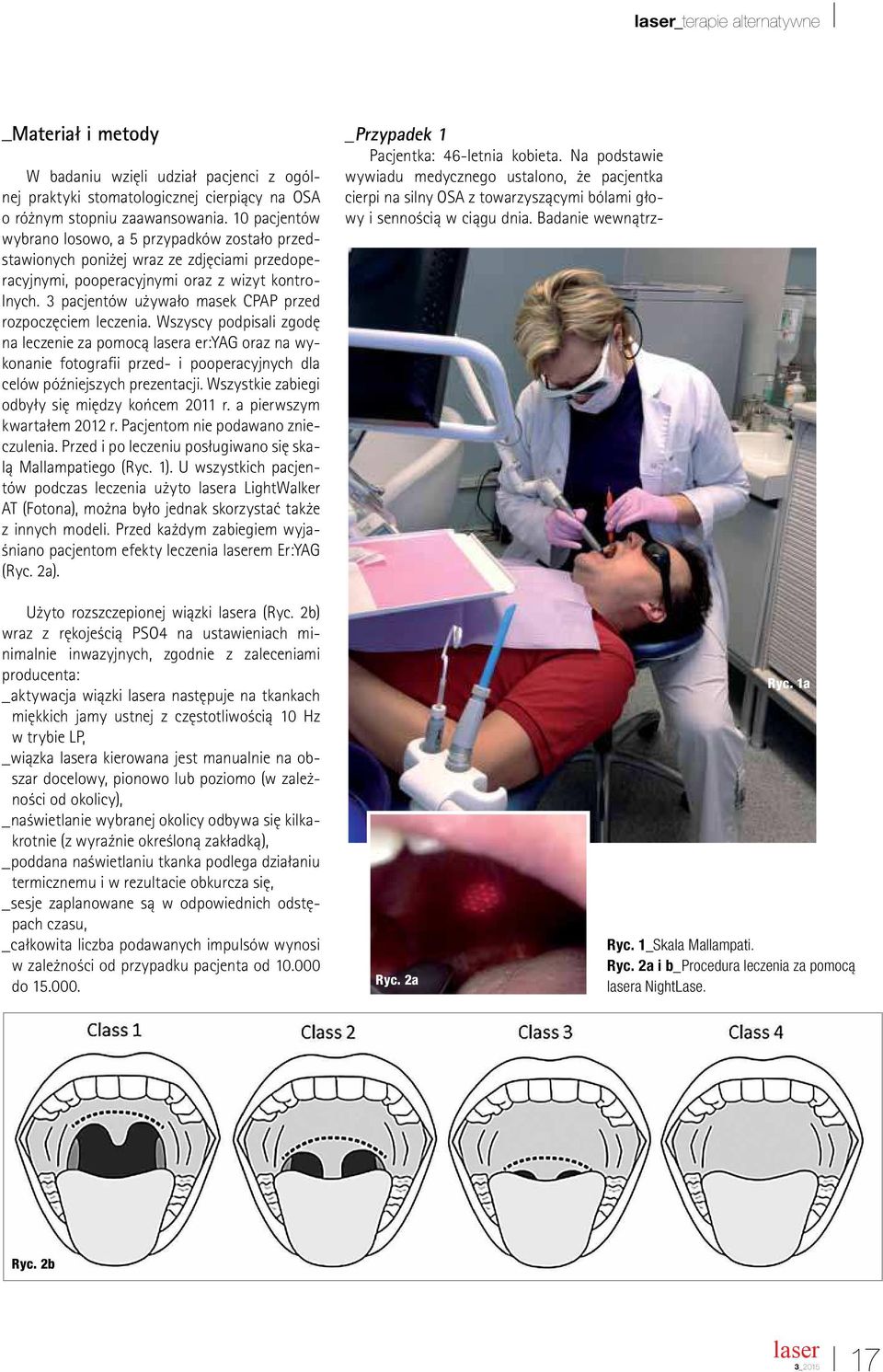 3 pacjentów używało masek CPAP przed rozpoczęciem leczenia.