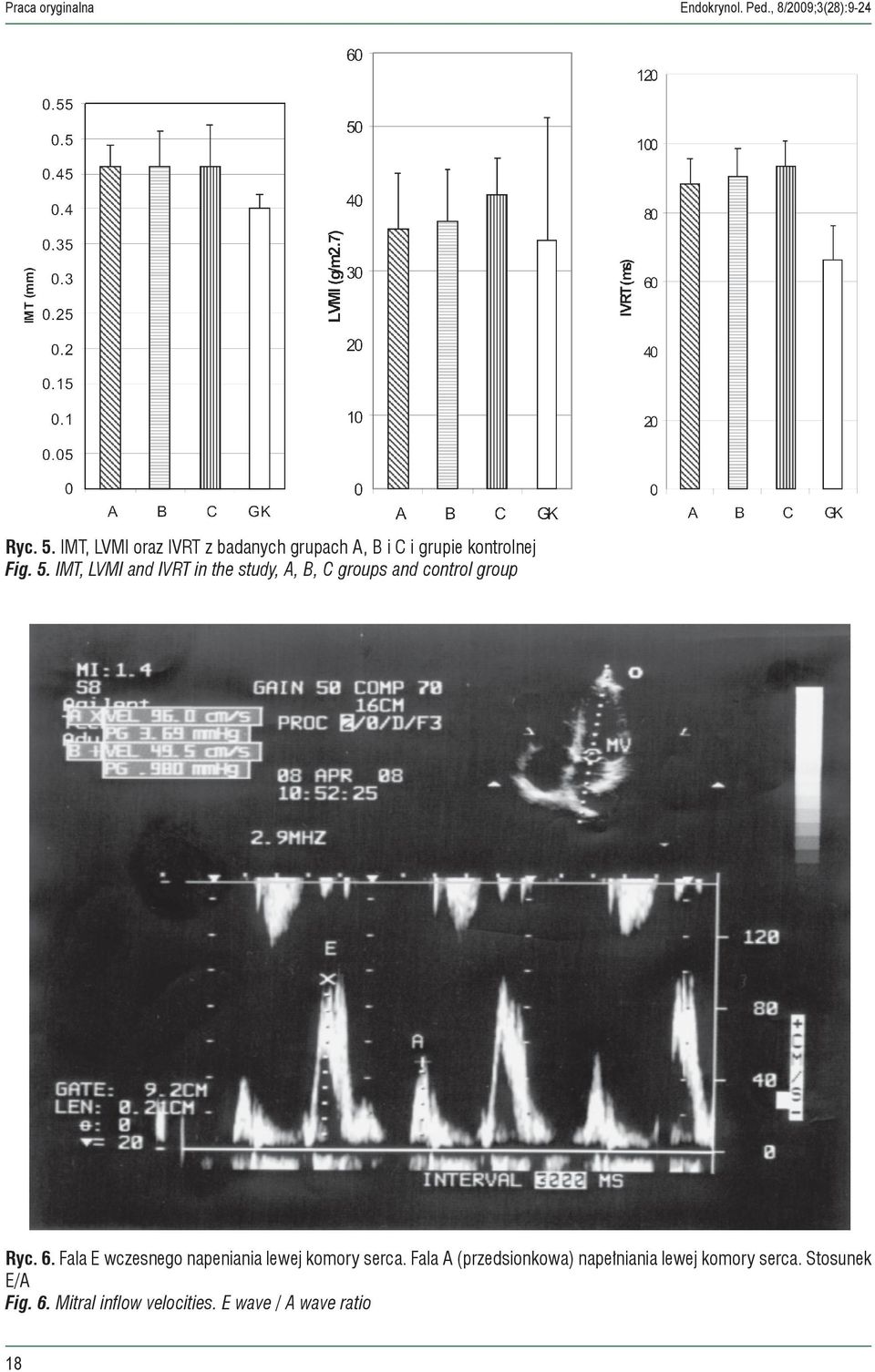 IMT, LVMI and IVRT in the study, A, B, C groups and control group Ryc. 6.