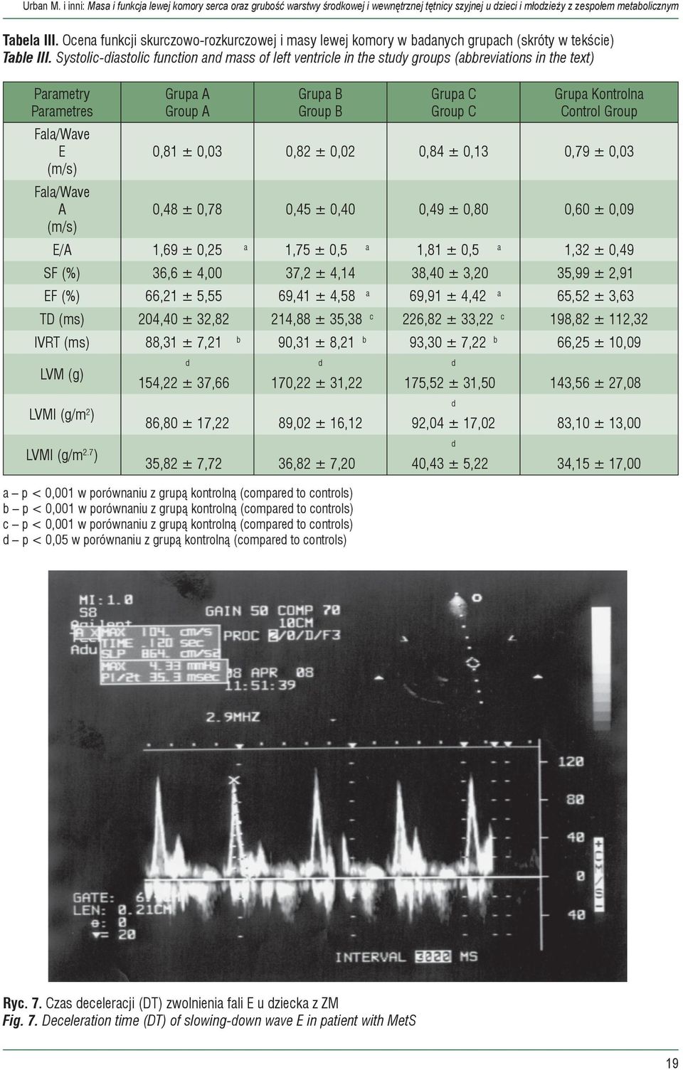 Systolic-diastolic function and mass of left ventricle in the study groups (abbreviations in the text) Parametry Parametres Fala/Wave E (m/s) Fala/Wave A (m/s) Grupa A Group A Grupa B Group B Grupa C