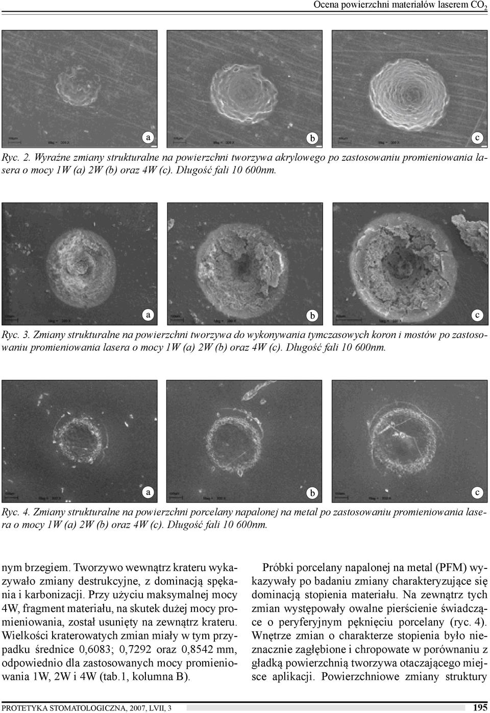 Długość fali 10 600nm. Ryc. 4. Zmiany strukturalne na powierzchni porcelany napalonej na metal po zastosowaniu promieniowania lasera o mocy 1W (a) 2W (b) oraz 4W (c). Długość fali 10 600nm.