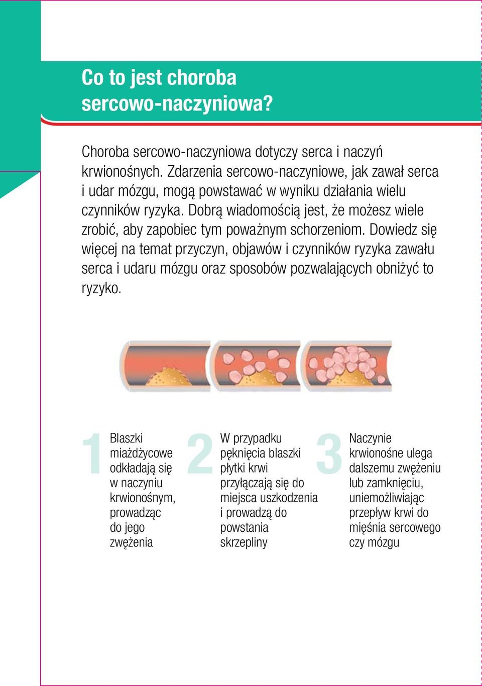 Dobrą wiadomością jest, że możesz wiele zrobić, aby zapobiec tym poważnym schorzeniom.