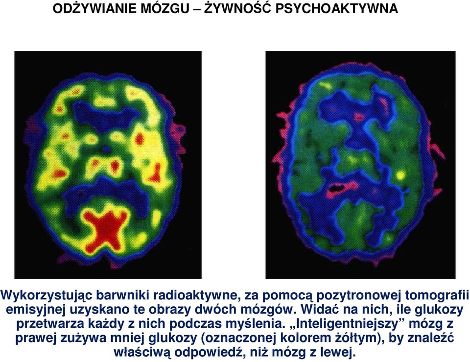 Widać na nich, ile glukozy przetwarza kaŝdy z nich podczas myślenia.