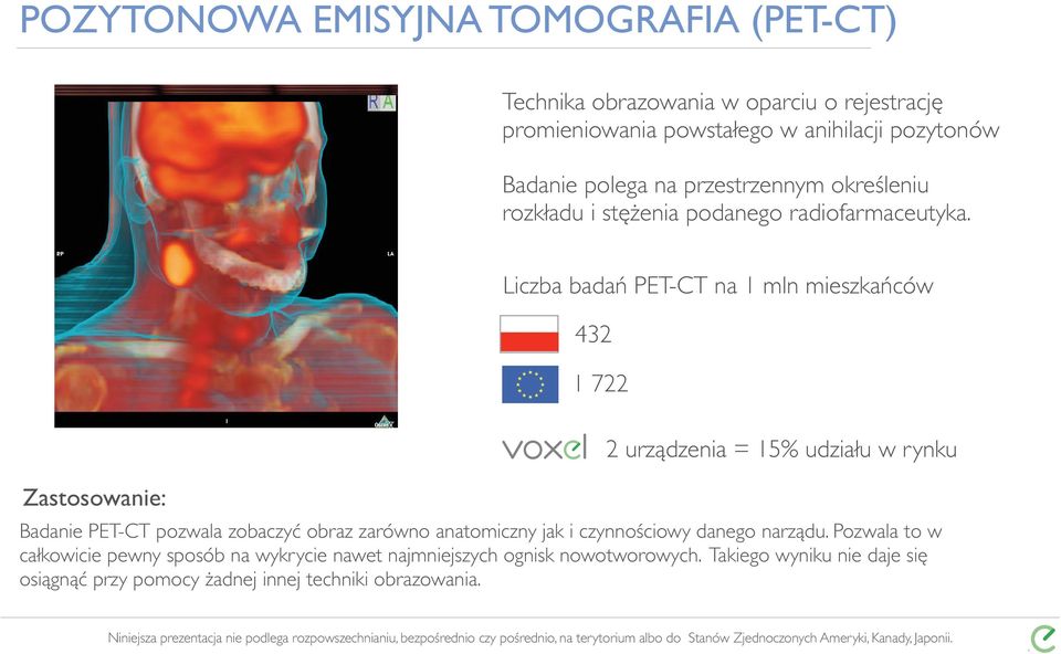 Liczba badań PET-CT na 1 mln mieszkańców 432 1 722 Zastosowanie: 2 urządzenia = 15% udziału w rynku Badanie PET-CT pozwala zobaczyć obraz zarówno