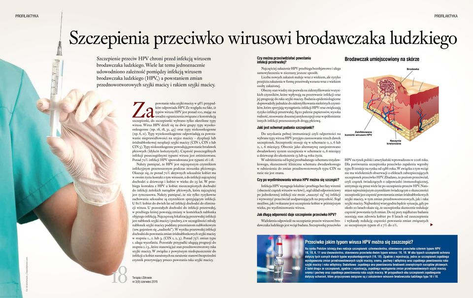 18 Terapia raka szyjki macicy w 98% przypadków odpowiada HPV.