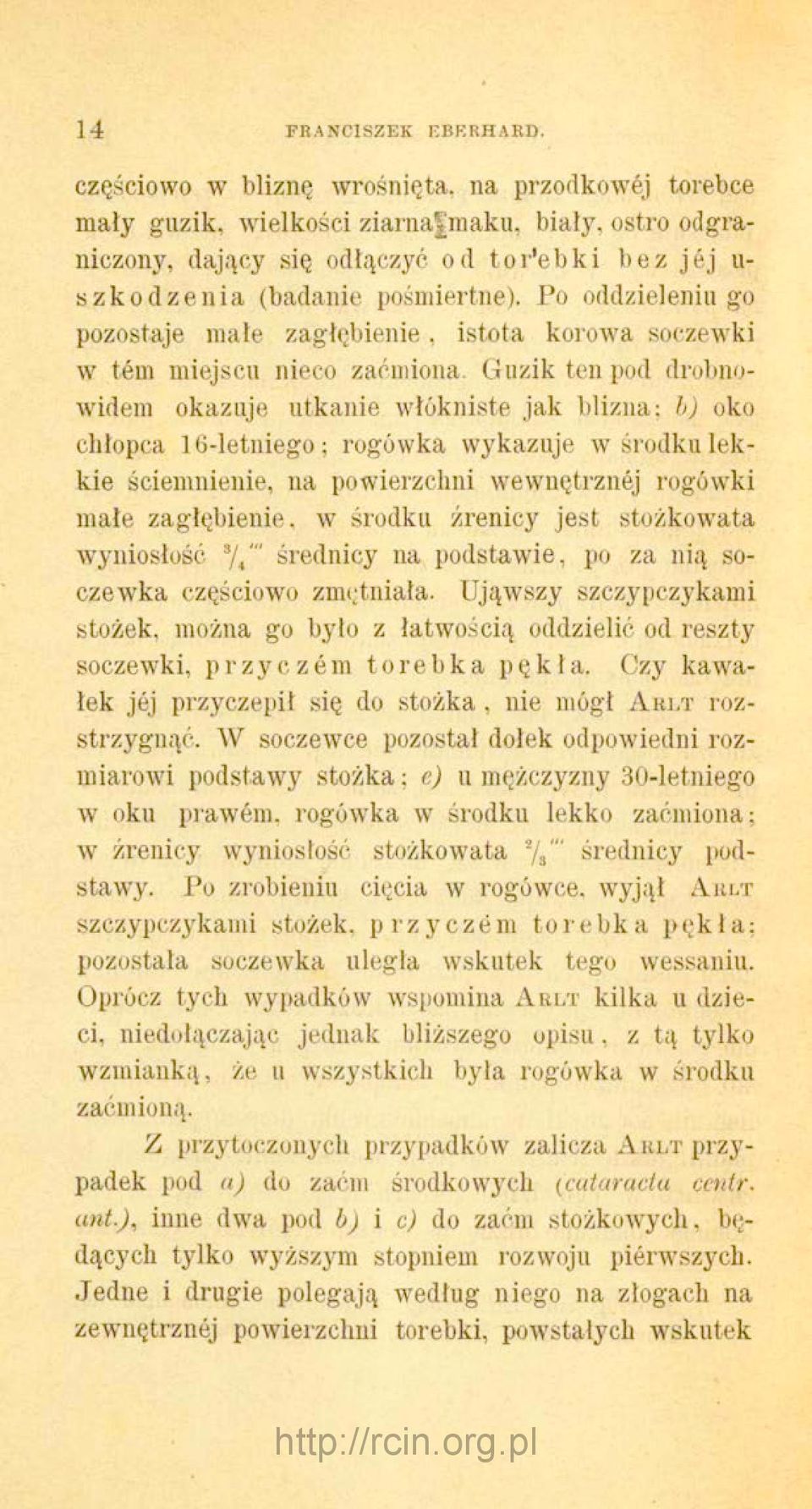 Po oddzieleniu go pozostaje małe zagłębienie, istota korowa soczewki w tem miejscu nieco zaćmiona.