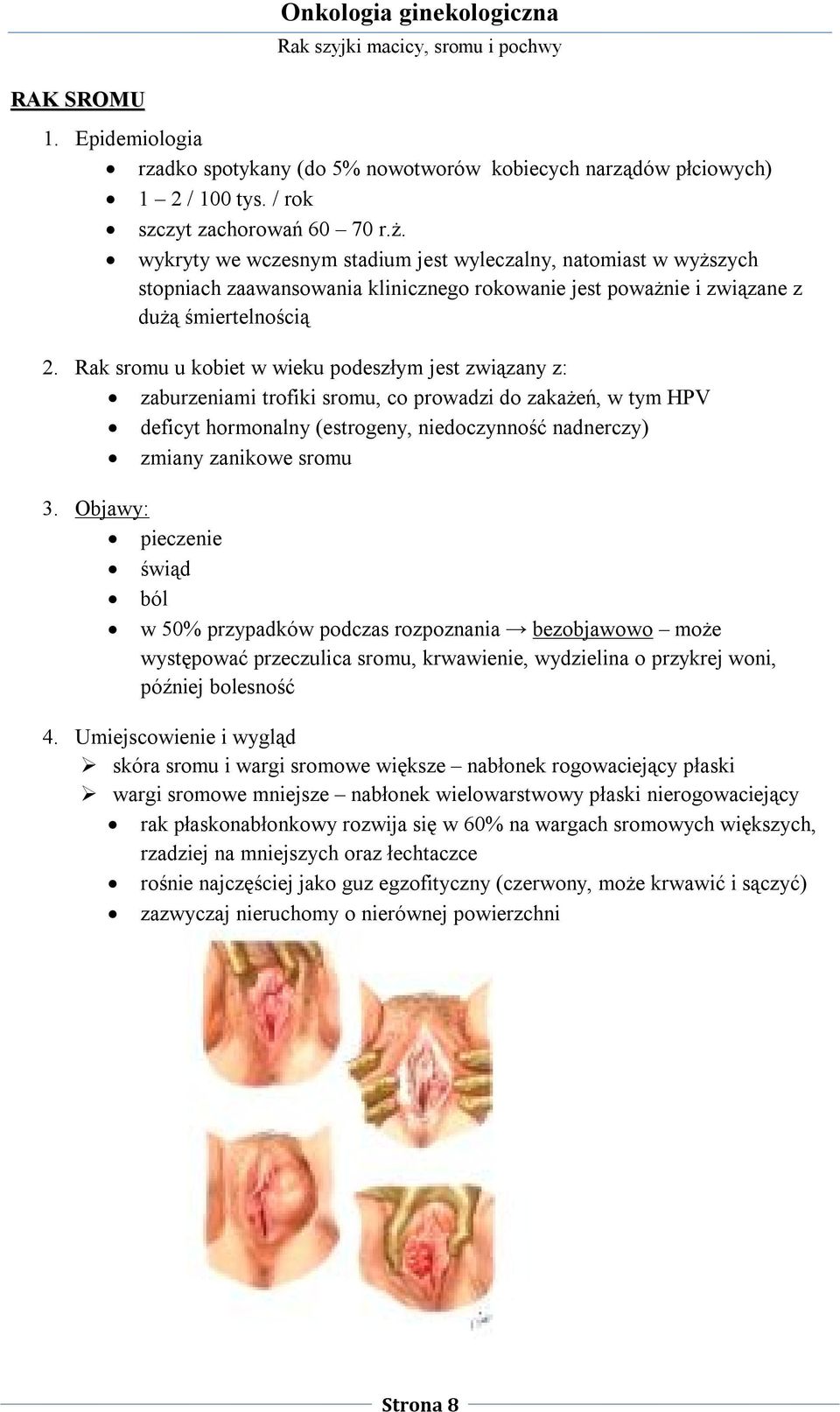 Rak sromu u kobiet w wieku podeszłym jest związany z: zaburzeniami trofiki sromu, co prowadzi do zakażeń, w tym HPV deficyt hormonalny (estrogeny, niedoczynność nadnerczy) zmiany zanikowe sromu 3.