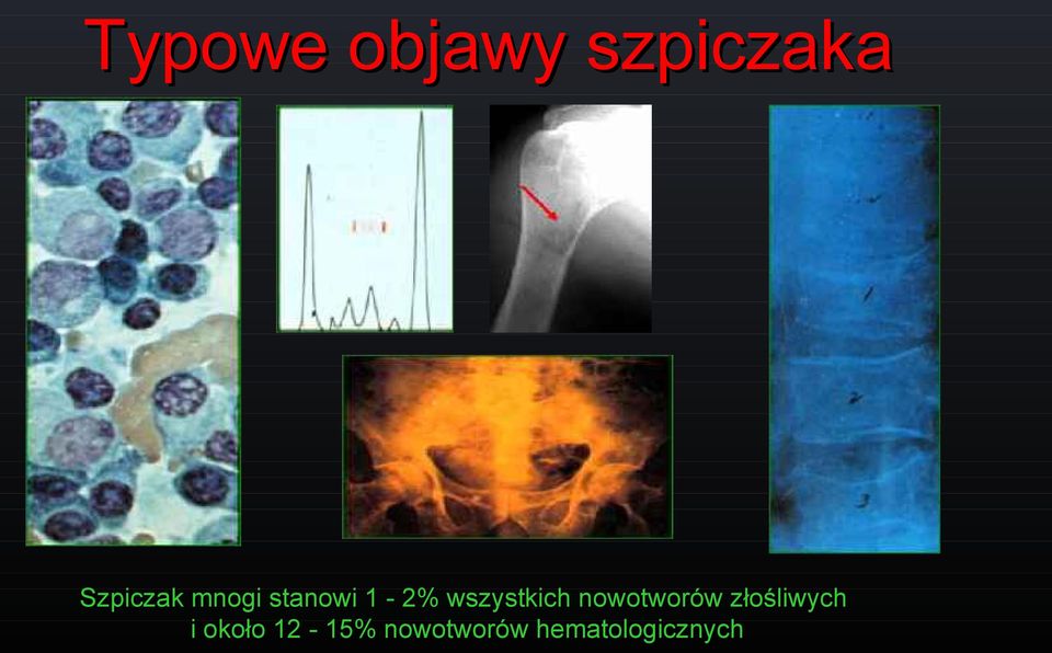 wszystkich nowotworów