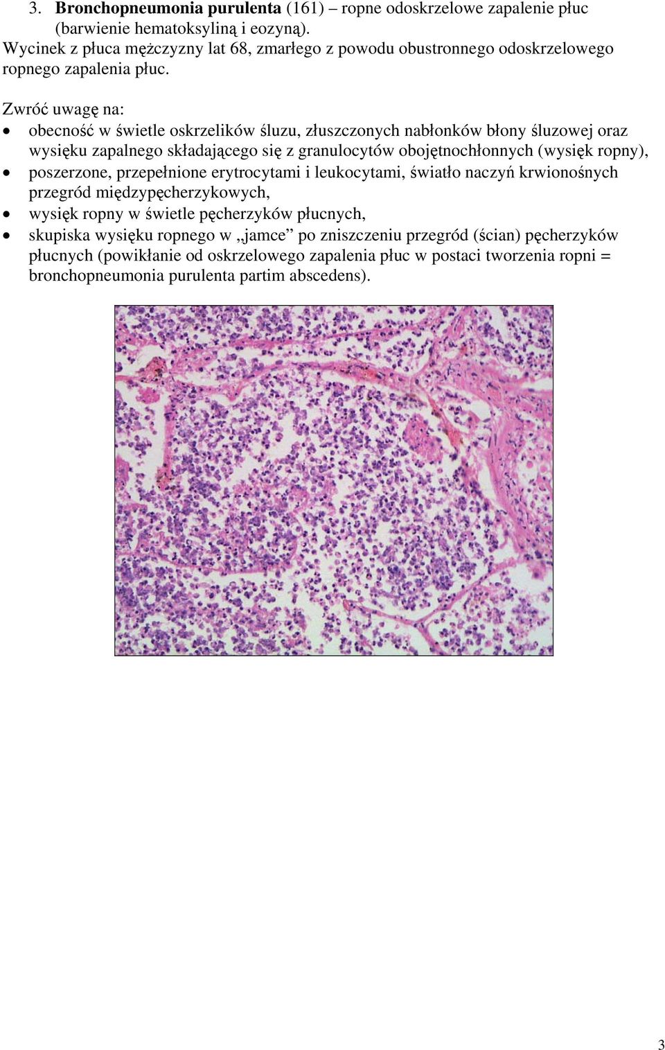 obecność w świetle oskrzelików śluzu, złuszczonych nabłonków błony śluzowej oraz wysięku zapalnego składającego się z granulocytów obojętnochłonnych (wysięk ropny), poszerzone,