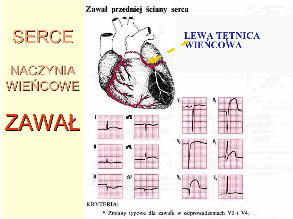 WIEŃCOWA