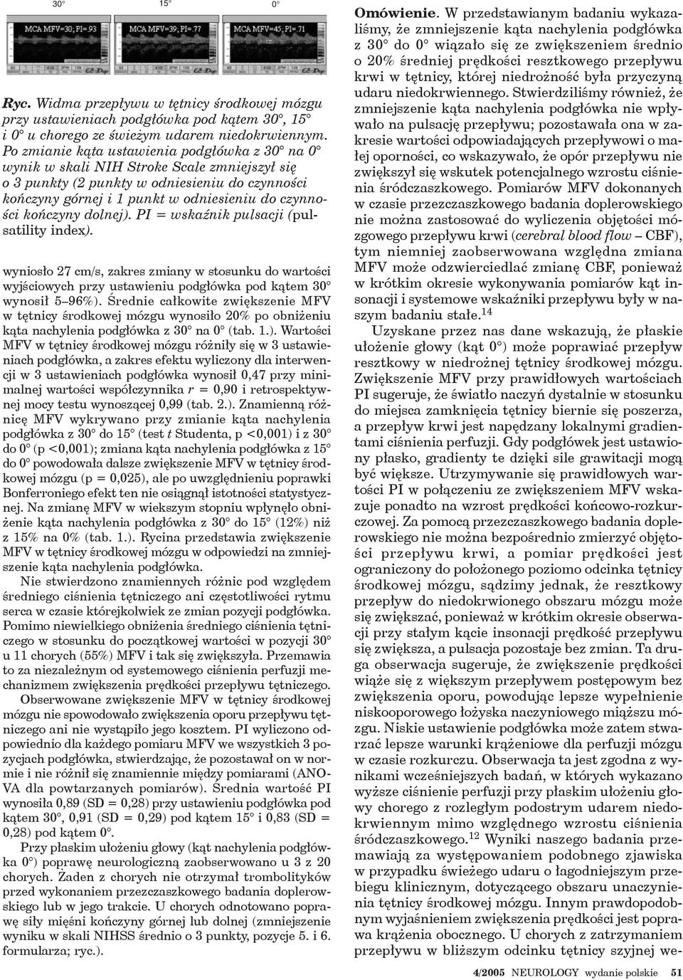 kończyny dolnej). PI = wskaźnik pulsacji (pulsatility index). wyniosło 27 cm/s, zakres zmiany w stosunku do wartości wyjściowych przy ustawieniu podgłówka pod kątem 30 wynosił 5 96%).