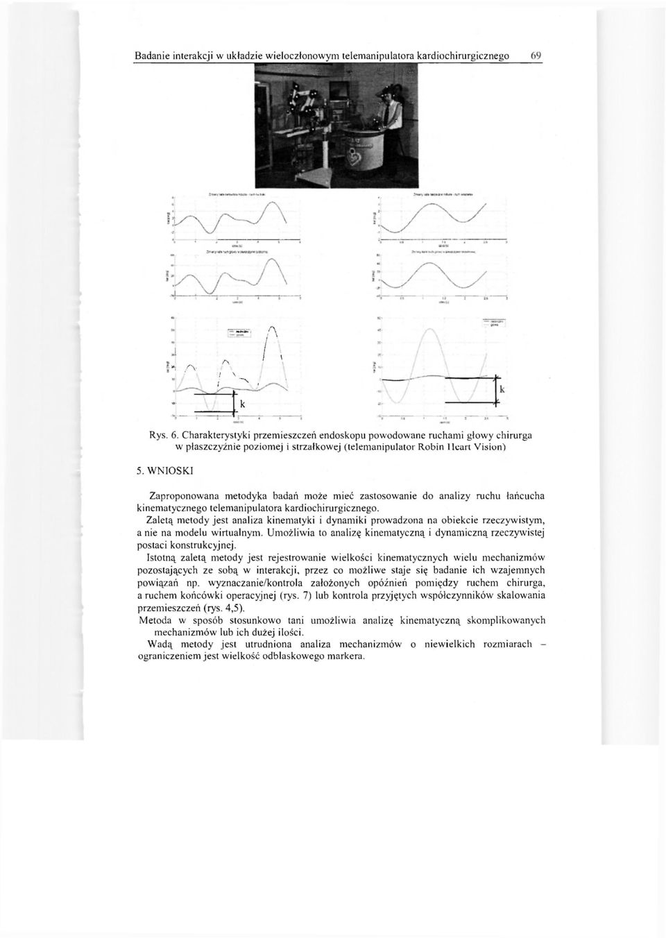 Charakterystyki przemieszczeń endoskopu powodowane ruchami głowy chirurga w płaszczyźnie poziomej i strzałkowej (telemanipulator Robin Heart Vision) 5.