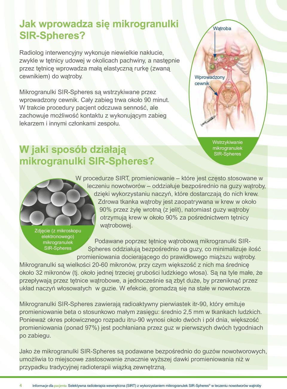 Mikrogranulki SIR-Spheres są wstrzykiwane przez wprowadzony cewnik. Cały zabieg trwa około 90 minut.