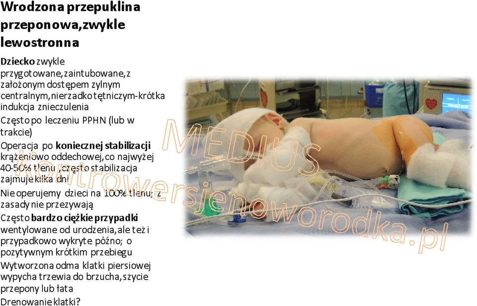 stabilizacja zajmuje kilka dni Nie operujemy dzieci na 100% tlenu; z zasady nie przezywają Często bardzo ciężkie przypadki wentylowane od urodzenia,ale też i