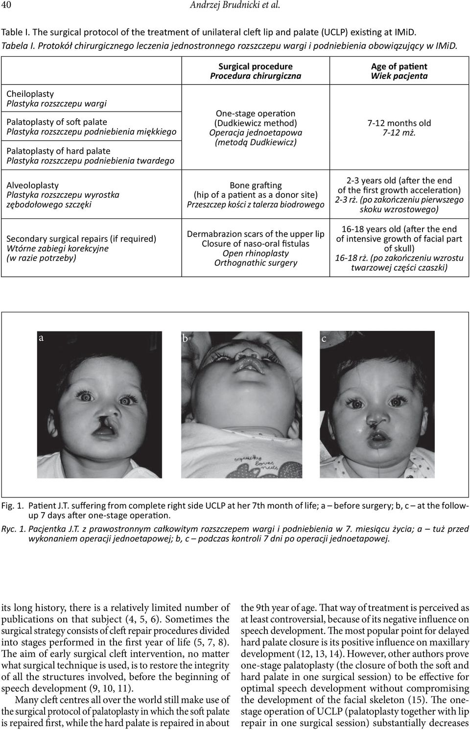 Cheiloplasty Plastyka rozszczepu wargi Palatoplasty of so palate Plastyka rozszczepu podniebienia miękkiego Palatoplasty of hard palate Plastyka rozszczepu podniebienia twardego Alveoloplasty