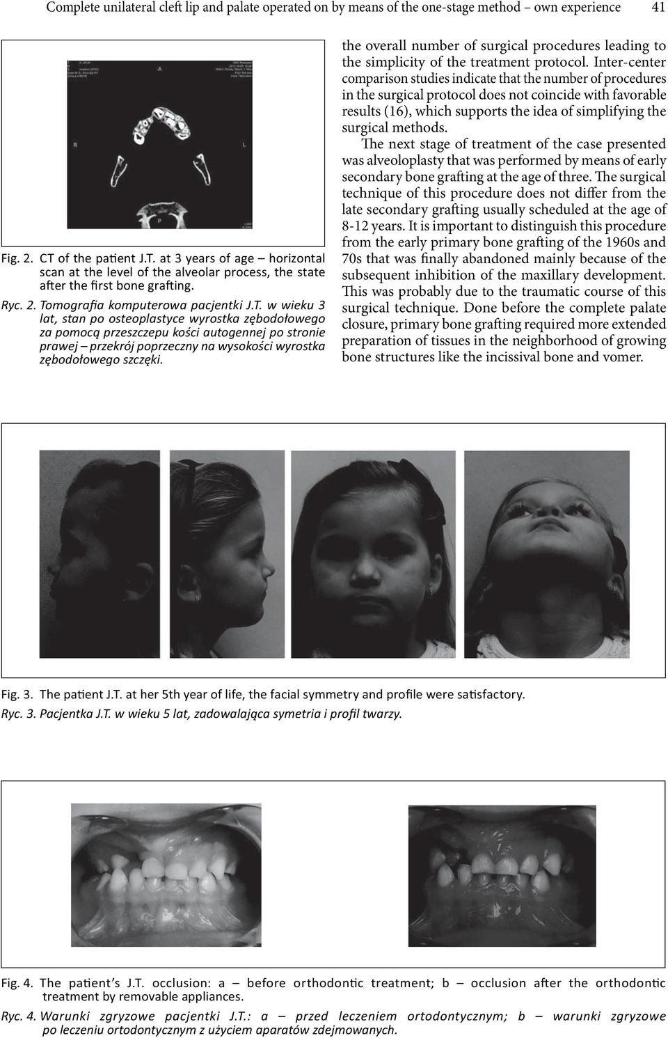 the overall number of surgical procedures leading to the simplicity of the treatment protocol.