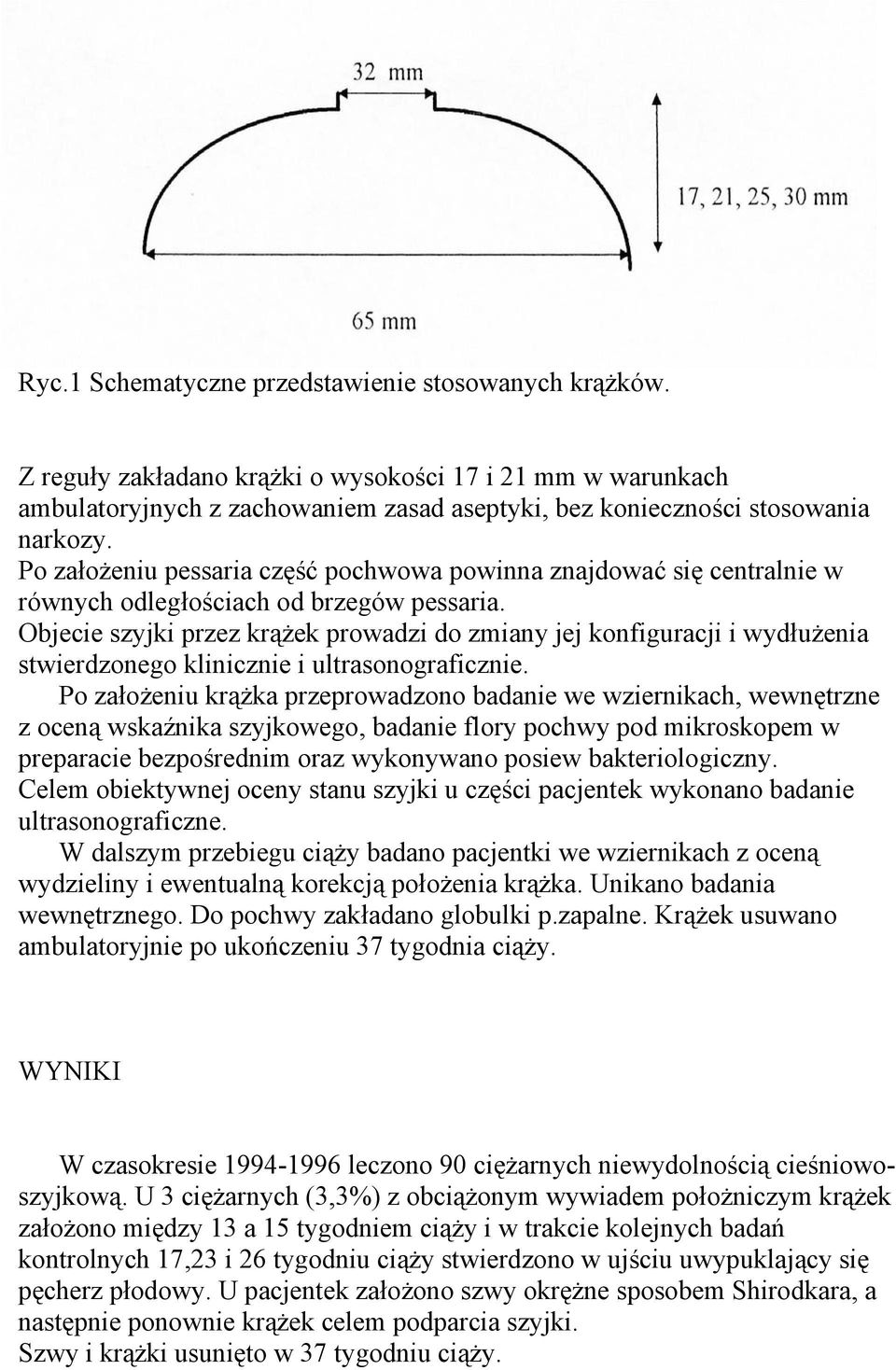 Objecie szyjki przez krążek prowadzi do zmiany jej konfiguracji i wydłużenia stwierdzonego klinicznie i ultrasonograficznie.