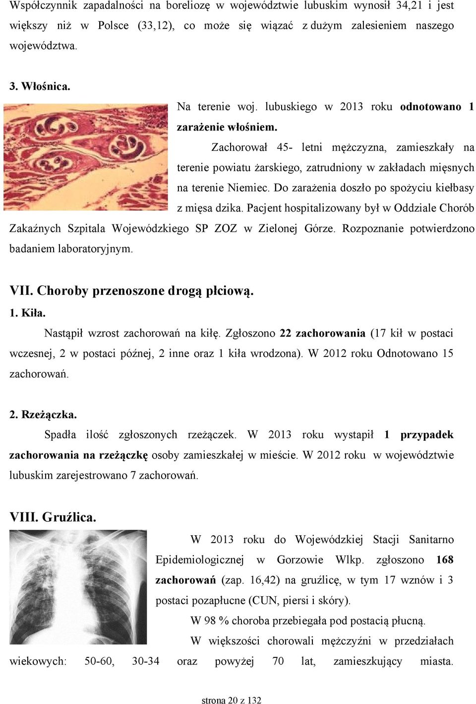 Do zarażenia doszło po spożyciu kiełbasy z mięsa dzika. Pacjent hospitalizowany był w Oddziale Chorób Zakaźnych Szpitala Wojewódzkiego SP ZOZ w Zielonej Górze.