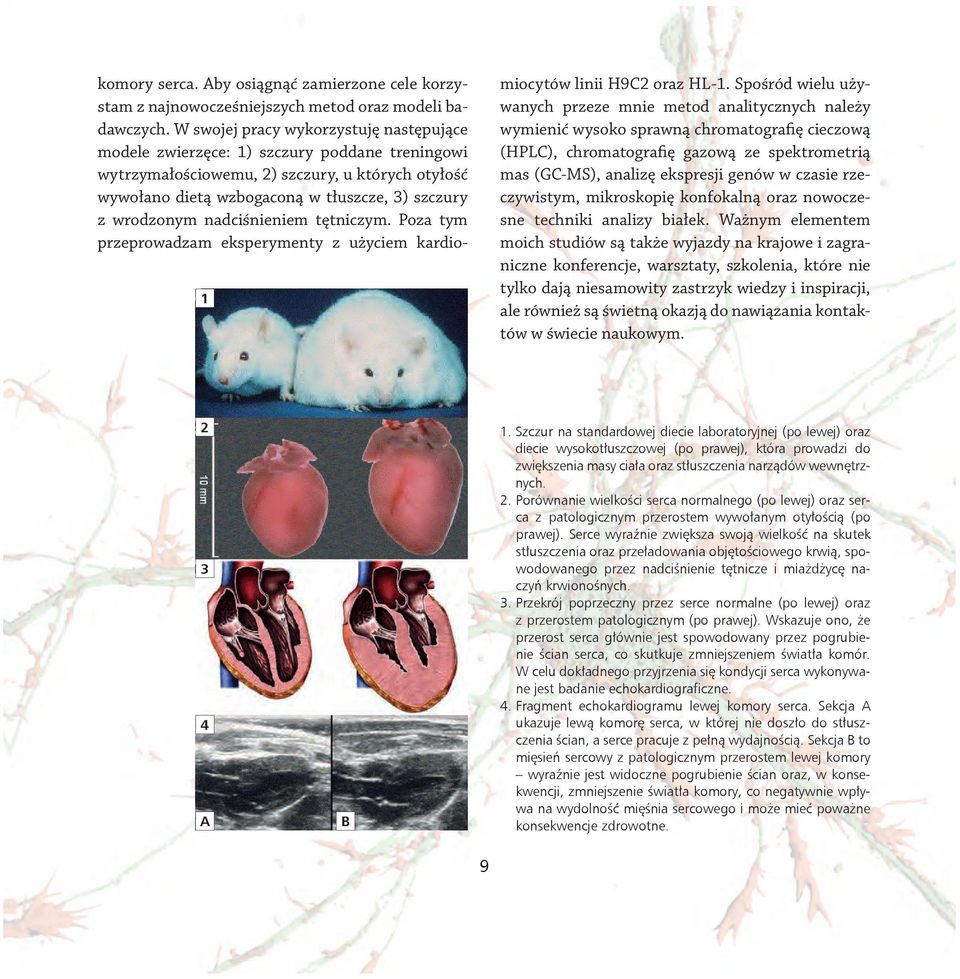 nadciśnieniem tętniczym. Poza tym przeprowadzam eksperymenty z użyciem kardiomiocytów linii H9C2 oraz HL-1.