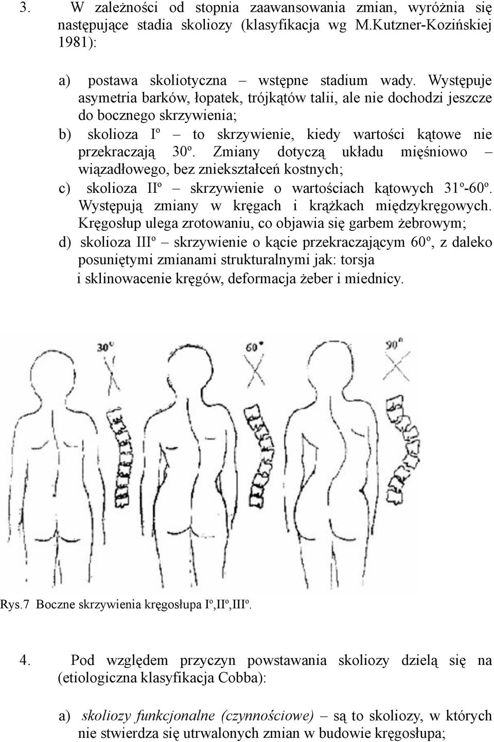 Zmiany dotyczą układu mięśniowo wiązadłowego, bez zniekształceń kostnych; c) skolioza II o skrzywienie o wartościach kątowych 31 o -60 o. Występują zmiany w kręgach i krążkach międzykręgowych.