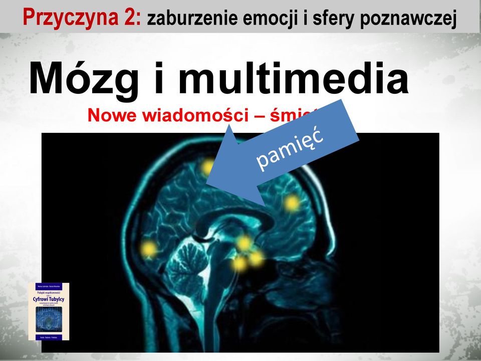 sfery poznawczej Mózg