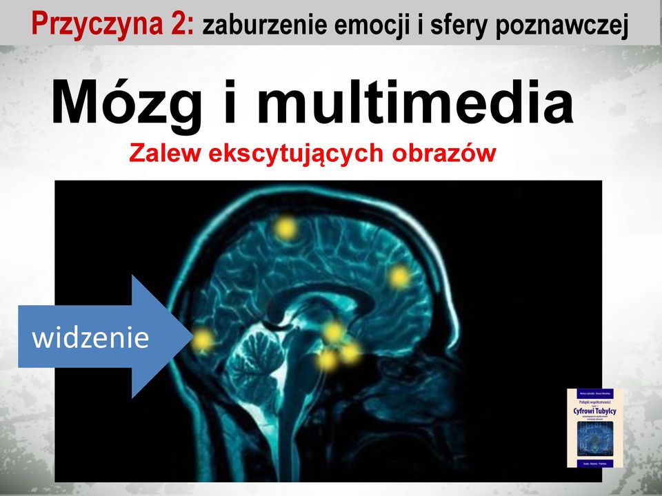 Mózg i multimedia Zalew