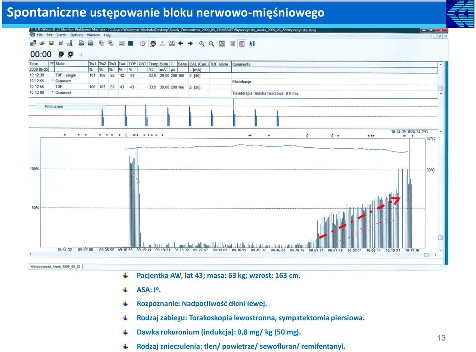 Rodzaj zabiegu: Torakoskopia lewostronna, sympatektomia piersiowa.