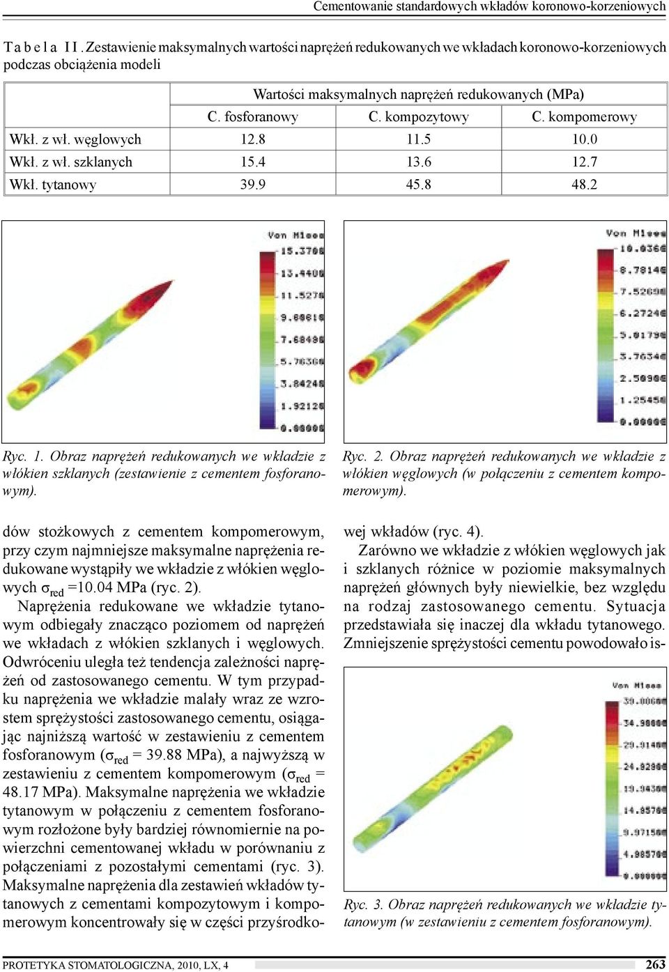 kompomerowy Wkł. z wł. węglowych 12.8 11.5 10.0 Wkł. z wł. szklanych 15.4 13.6 12.7 Wkł. tytanowy 39.9 45.8 48.2 Ryc. 1. Obraz naprężeń redukowanych we wkładzie z włókien szklanych (zestawienie z cementem fosforanowym).