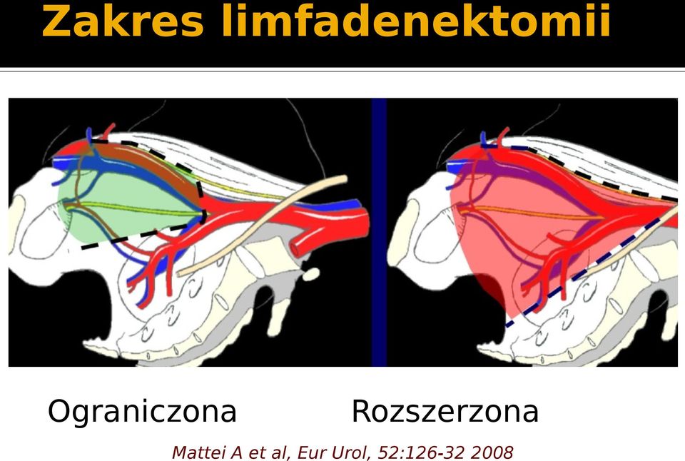 Ograniczona