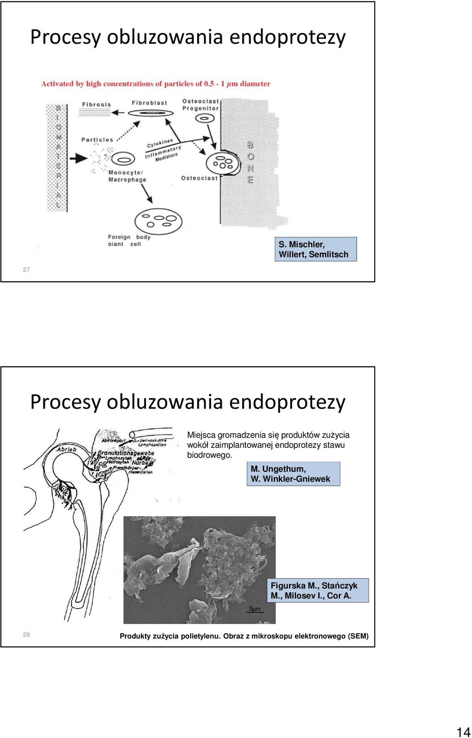 produktów zużycia wokół zaimplantowanej endoprotezy stawu biodrowego. M. Ungethum, W.