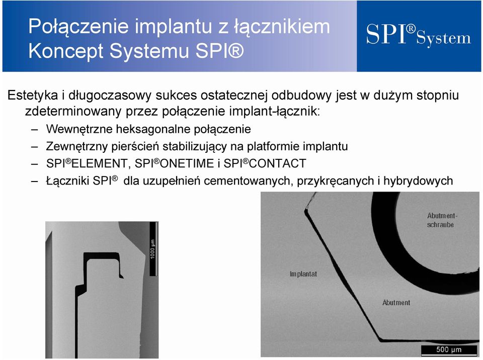 Wewnętrzne heksagonalne połączenie Zewnętrzny pierścień stabilizujący na platformie implantu