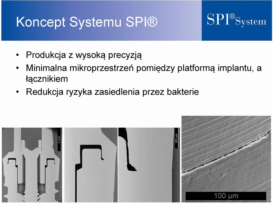 pomiędzy platformą implantu, a