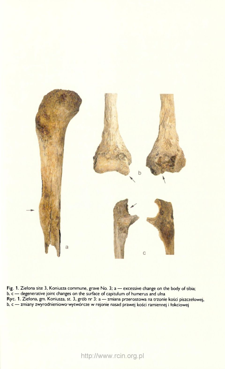 of capitulum of humerus and ulna Ryc. 1. Zielona, gm. Koniusza, st.