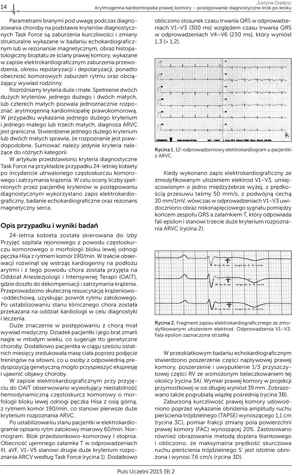 zapisie elektrokardiograficznym zaburzenia przewodzenia, okresu repolaryzacji i depolaryzacji, ponadto obecność komorowych zaburzeń rytmu oraz obciążający wywiad rodzinny.