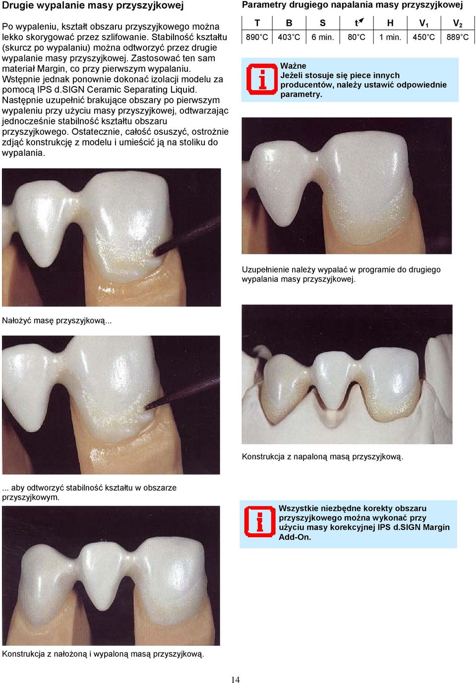 Wstępnie jednak ponownie dokonać izolacji modelu za pomocą IPS d.sign Ceramic Separating Liquid.