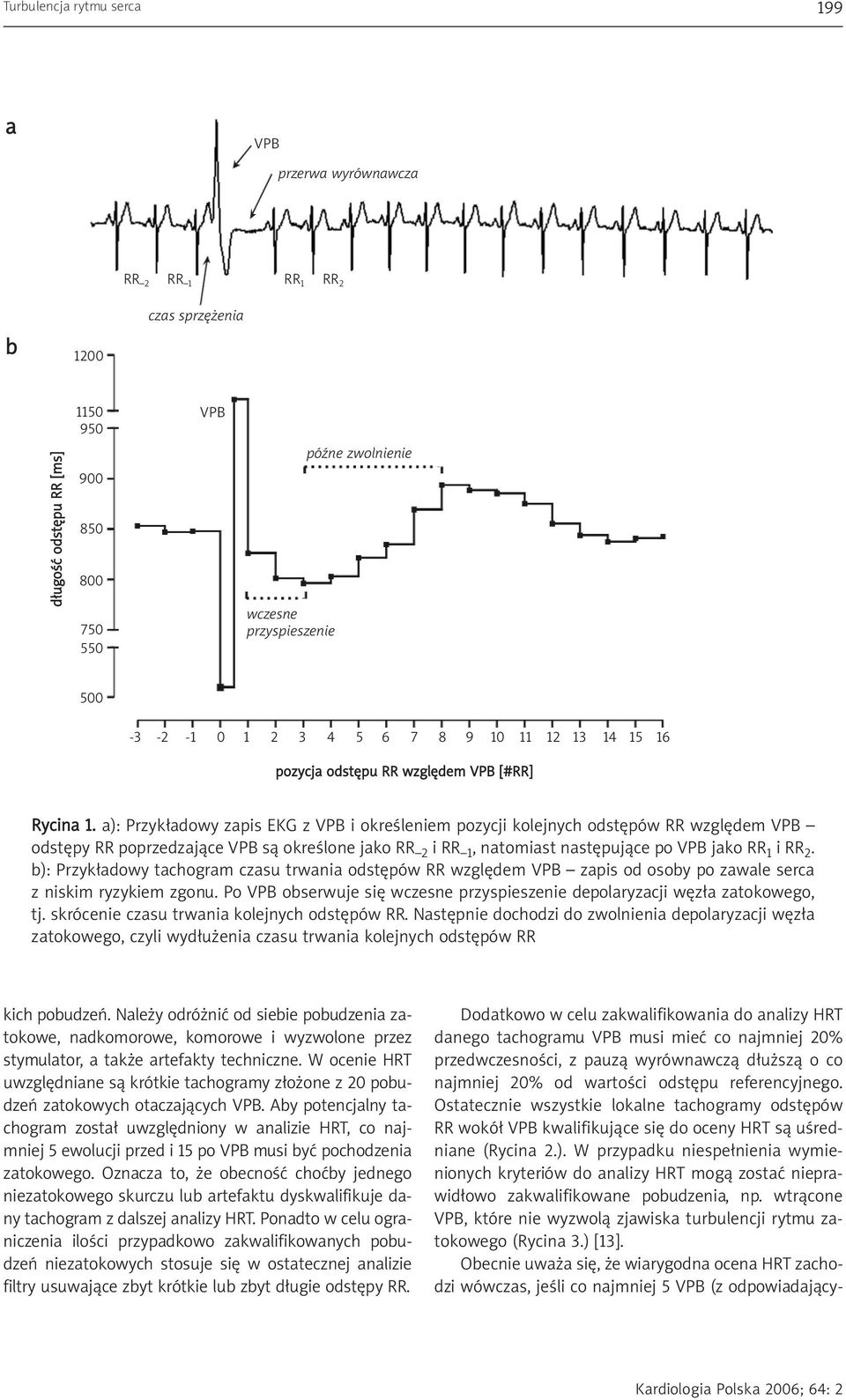a): Przykładowy zapis EKG z VPB i określeniem pozycji kolejnych odstępów RR względem VPB odstępy RR poprzedzające VPB są określone jako RR 2 irr 1, natomiast następujące po VPB jako RR 1 irr 2.
