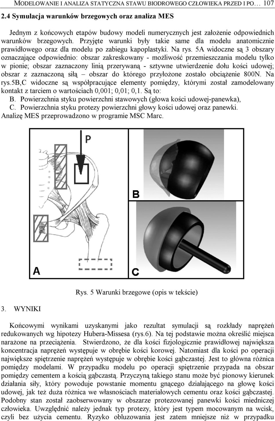 Przyjęte warunki były takie same dla modelu anatomicznie prawidłowego oraz dla modelu po zabiegu kapoplastyki. Na rys.