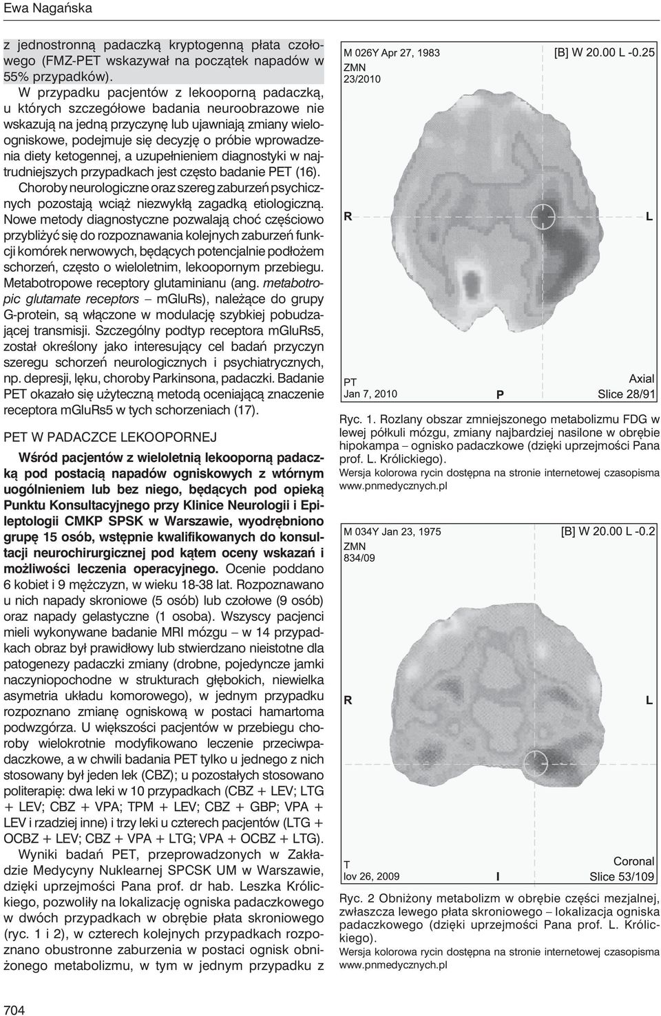 wprowadzenia diety ketogennej, a uzupełnieniem diagnostyki w najtrudniejszych przypadkach jest często badanie PET (16).