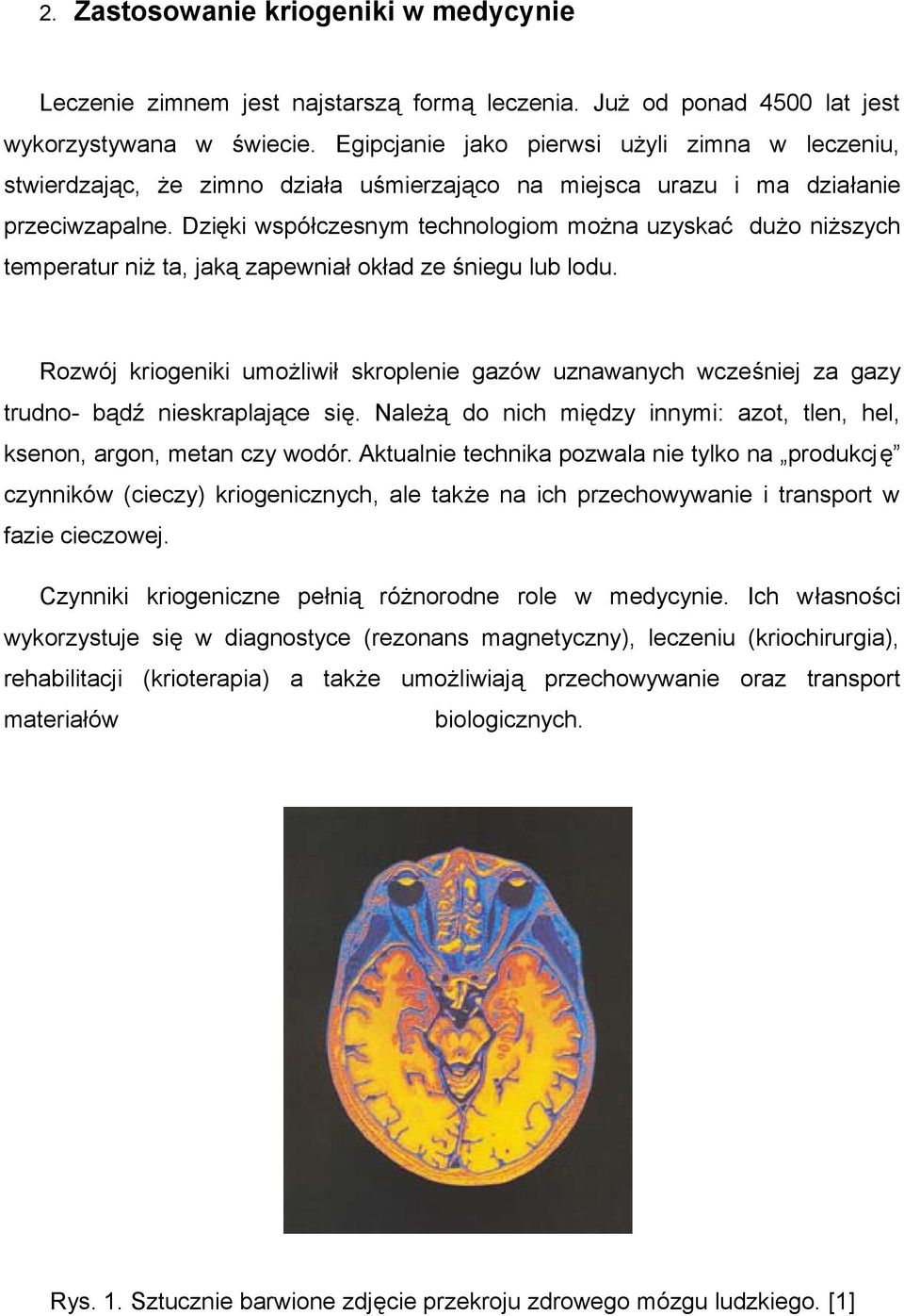 Dzięki współczesnym technologiom można uzyskać dużo niższych temperatur niż ta, jaką zapewniał okład ze śniegu lub lodu.