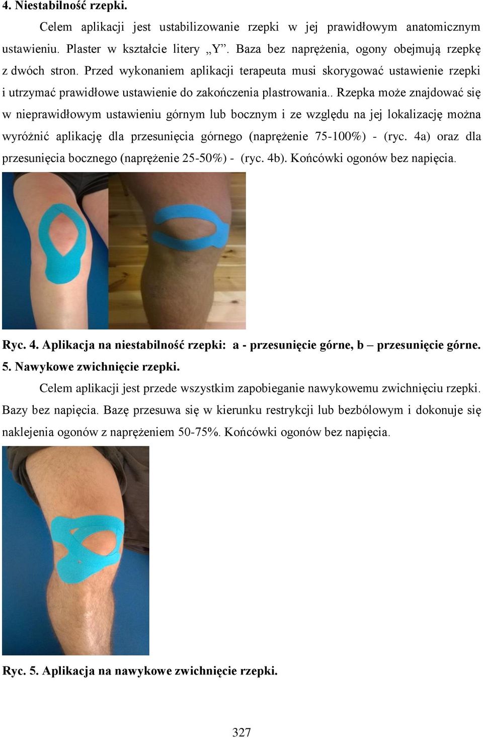 . Rzepka może znajdować się w nieprawidłowym ustawieniu górnym lub bocznym i ze względu na jej lokalizację można wyróżnić aplikację dla przesunięcia górnego (naprężenie 75-100%) - (ryc.