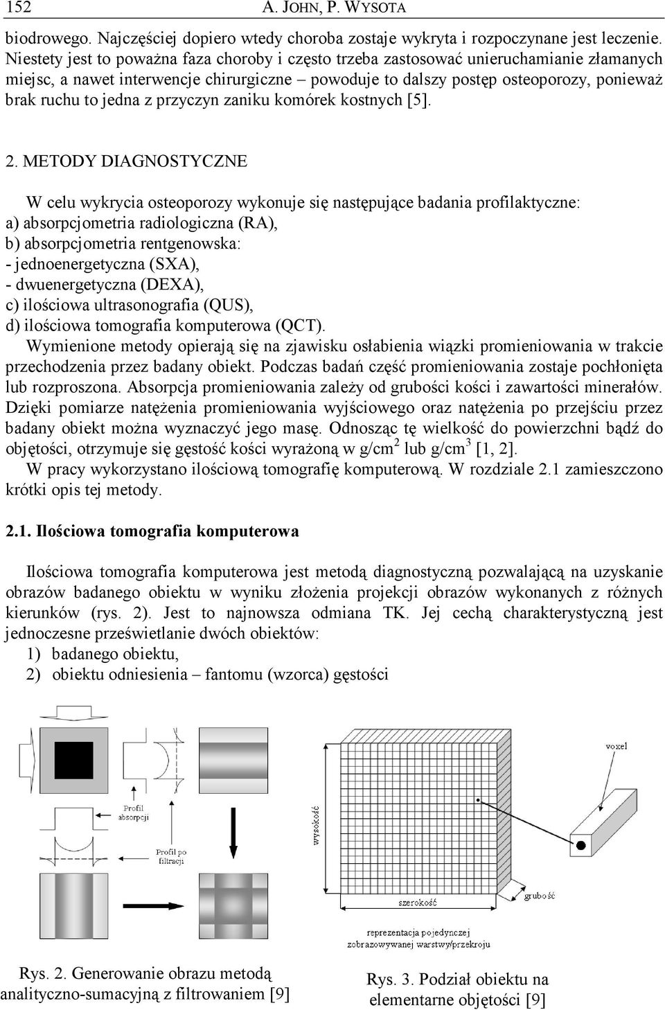 z przyczyn zaniku komórek kostnych [5]. 2.